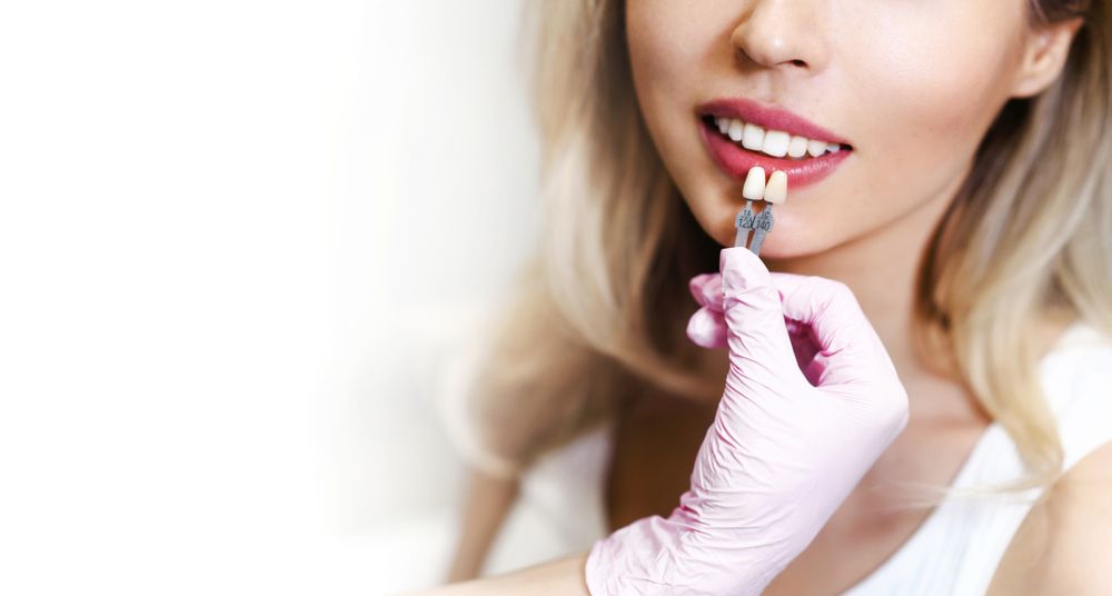 Are You a Candidate for Cosmetic Veneers? Factors to Consider Before Treatment