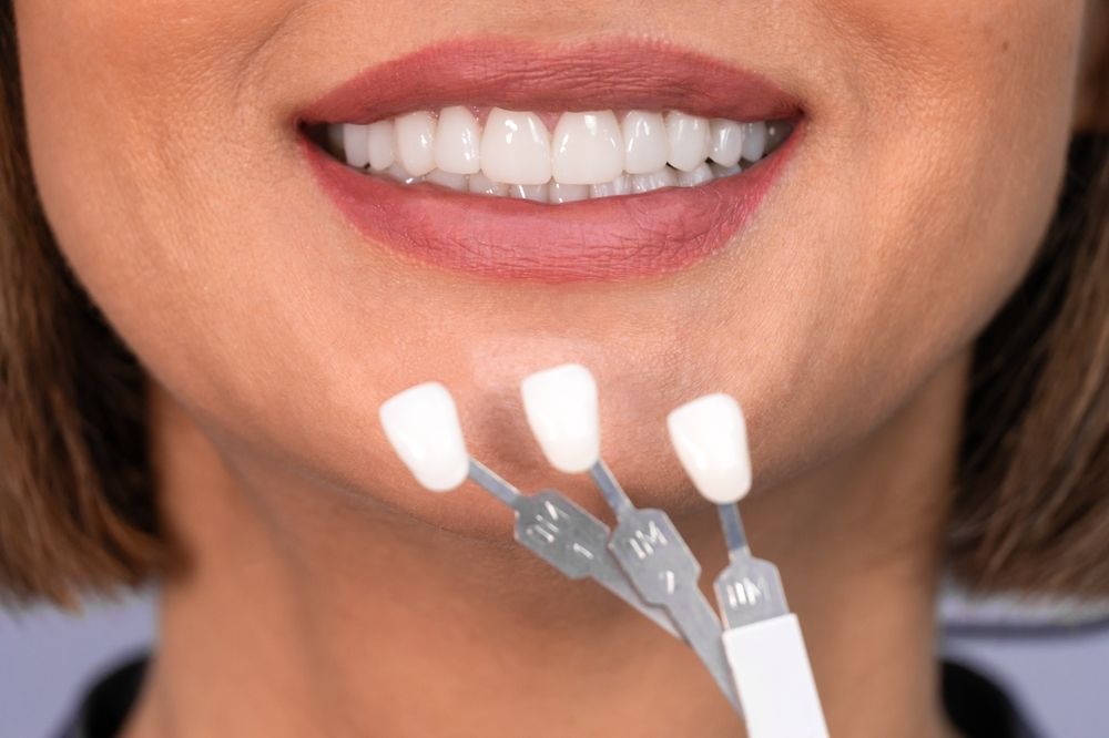 Why Choose Dental Implants Over Dentures?