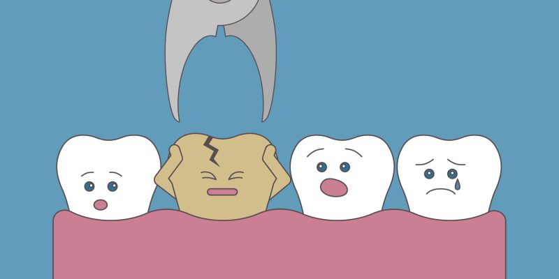 Bad tooth extraction. Good and bad teeth. Health care. Scared tooth.