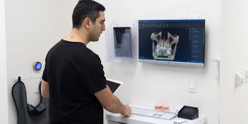 dentures_0000_BrightWhite-9256 (1)