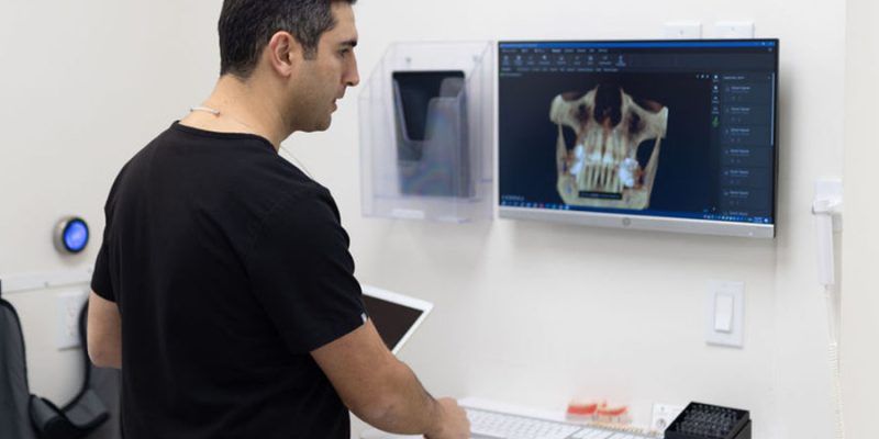 implants_0000_BrightWhite-9256