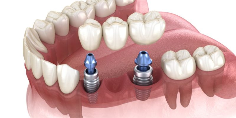 shutterstock_1505970347