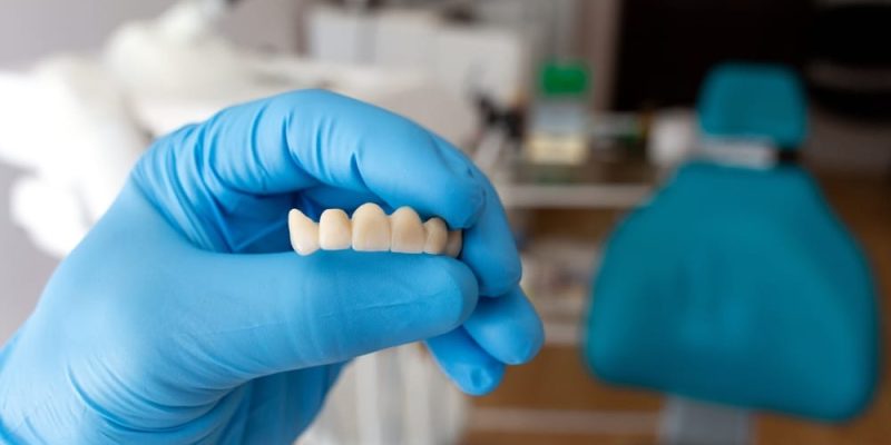 The,Dentist,Holds,A,Ceramic,,Zirconium,,Bridge-shaped,,Non-removable,Dental,Prosthesis