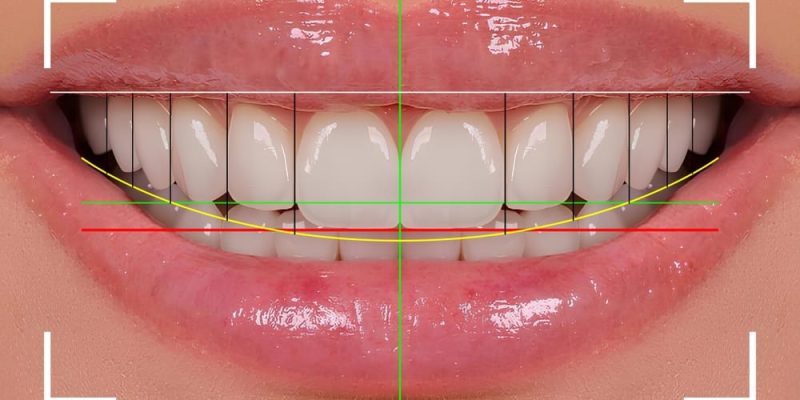 Computer-aided,Design,For,Tooth,Alignment,And,Smile,Design,Treatment,In