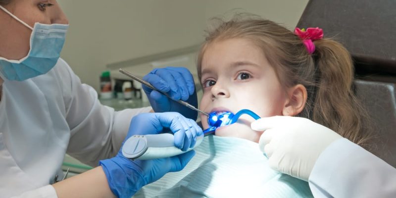 Dental Sealants for kids