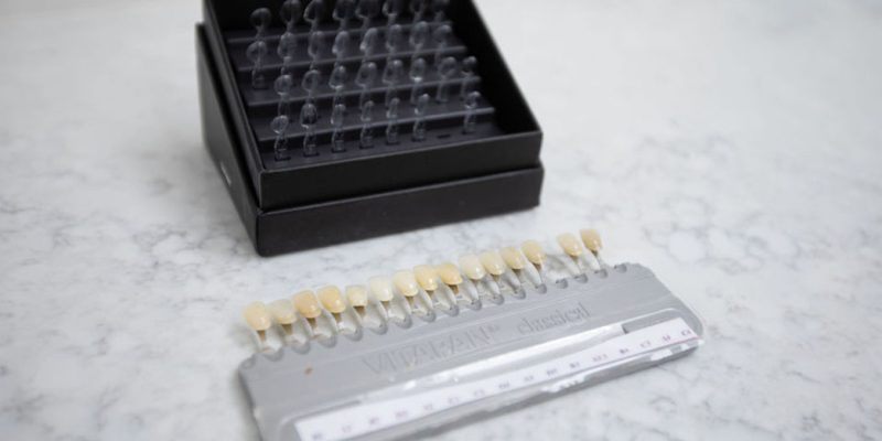 Cosmetic Veneers kit